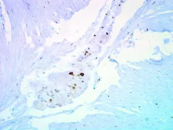 Anti-p27 Kip1 antibody used in IHC (Paraffin sections) (IHC-P). GTX100446